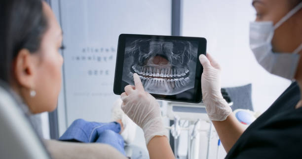 Licensed Wisdom Tooth Removal service in Edisto, SC - Smile Center Dentistry